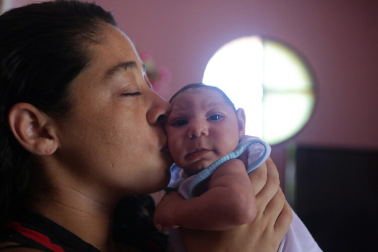 Keadaaan bayi yang dijangkiti virus Zika. Foto - google.com