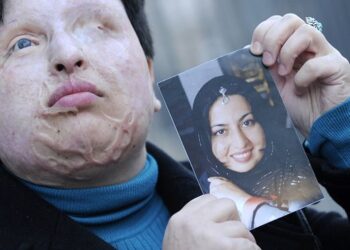 .Ameneh Bahrami, salah satu mangsa yang menjadi buta akibat serangan asid beberapa tahun sebelum itu, menggunakan hak untuk mendapat tuntutan ganti rugi daripada penyerangnya. Foto - The Guardian